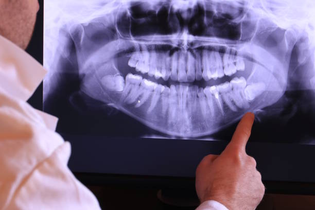 Best Same-Day Emergency Dentist in Commerce, CA