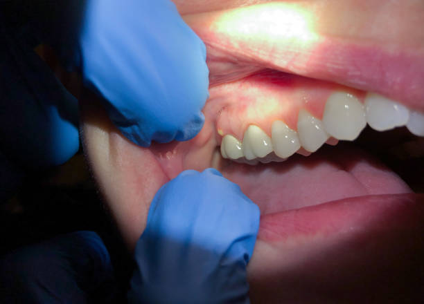 Best Emergency Dental Care for Trauma or Injury in Commerce, CA